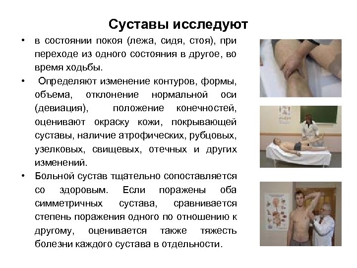Суставы исследуют • в состоянии покоя (лежа, сидя, стоя), при переходе из одного состояния