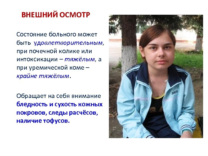 ВНЕШНИЙ ОСМОТР Состояние больного может быть удовлетворительным, при почечной колике или интоксикации – тяжёлым,