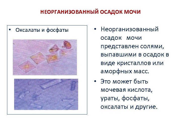 НЕОРГАНИЗОВАННЫЙ ОСАДОК МОЧИ • Оксалаты и фосфаты • Неорганизованный осадок мочи представлен солями, выпавшими