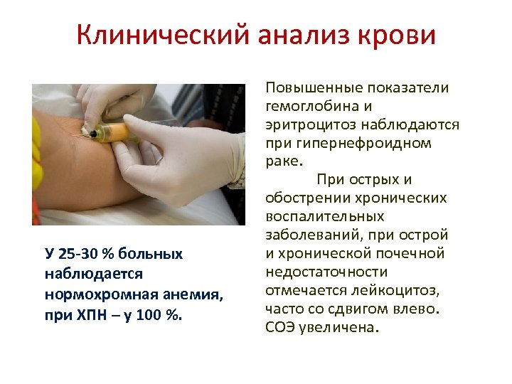 Клинический анализ крови У 25 -30 % больных наблюдается нормохромная анемия, при ХПН –