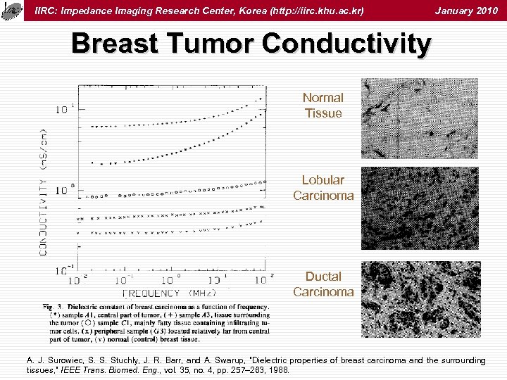 IIRC: Impedance Imaging Research Center, Korea (http: //iirc. khu. ac. kr) January 2010 Breast