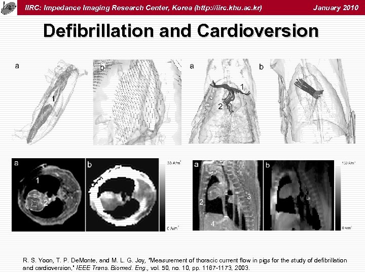 IIRC: Impedance Imaging Research Center, Korea (http: //iirc. khu. ac. kr) January 2010 Defibrillation