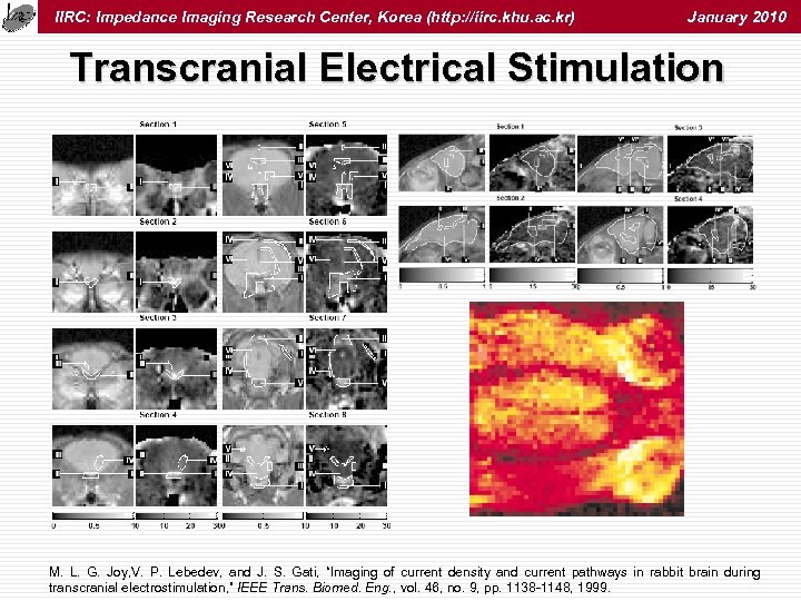 IIRC: Impedance Imaging Research Center, Korea (http: //iirc. khu. ac. kr) January 2010 Transcranial