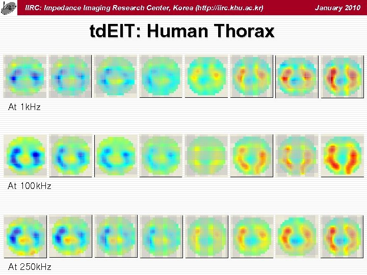 IIRC: Impedance Imaging Research Center, Korea (http: //iirc. khu. ac. kr) td. EIT: Human