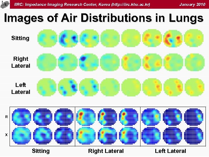 IIRC: Impedance Imaging Research Center, Korea (http: //iirc. khu. ac. kr) January 2010 Images