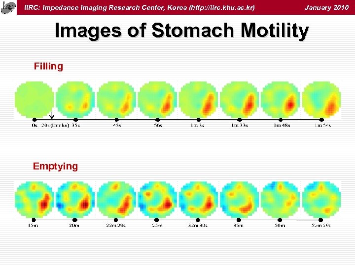 IIRC: Impedance Imaging Research Center, Korea (http: //iirc. khu. ac. kr) January 2010 Images