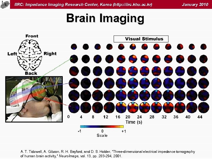 IIRC: Impedance Imaging Research Center, Korea (http: //iirc. khu. ac. kr) January 2010 Brain