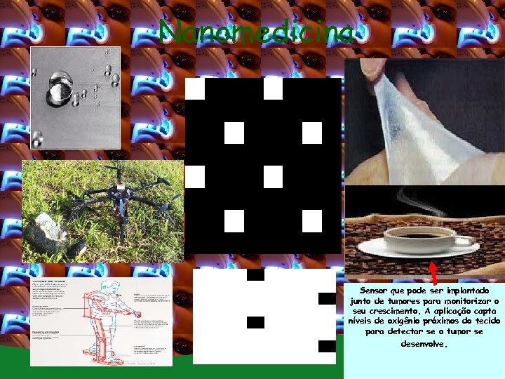 Nanomedicina Sensor que pode ser implantado junto de tumores para monitorizar o seu crescimento.