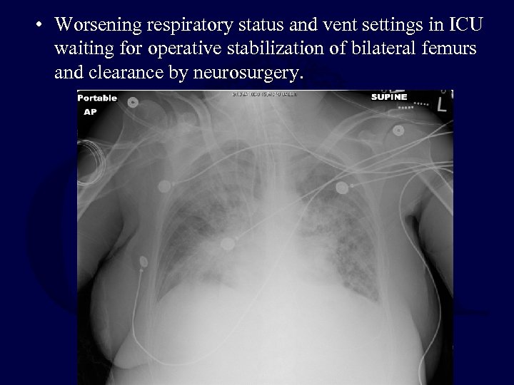  • Worsening respiratory status and vent settings in ICU waiting for operative stabilization