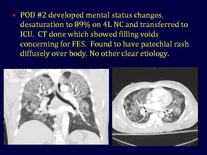  • POD #2 developed mental status changes, desaturation to 89% on 4 L