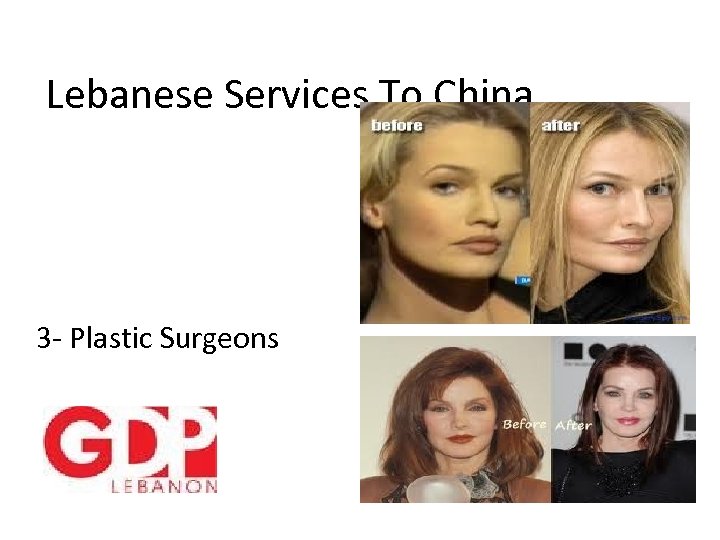 Lebanese Services To China 3 - Plastic Surgeons 