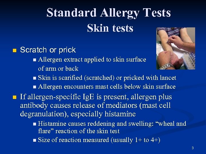 Standard Allergy Tests Skin tests n Scratch or prick n Allergen extract applied to