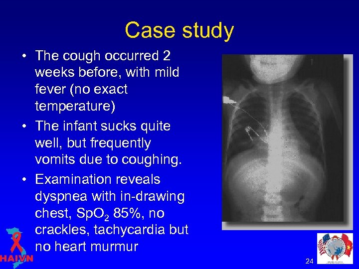 Case study • The cough occurred 2 weeks before, with mild fever (no exact
