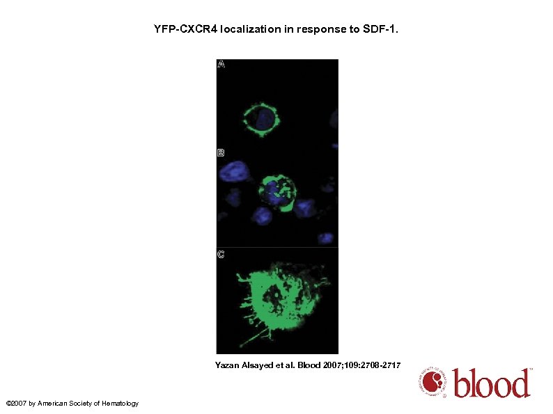 YFP-CXCR 4 localization in response to SDF-1. Yazan Alsayed et al. Blood 2007; 109: