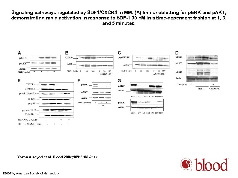 Signaling pathways regulated by SDF 1/CXCR 4 in MM. (A) Immunoblotting for p. ERK