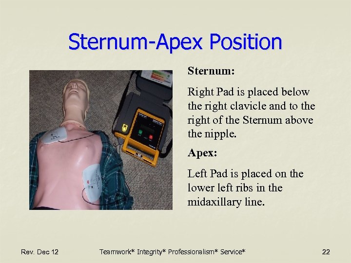 Sternum-Apex Position Sternum: Right Pad is placed below the right clavicle and to the