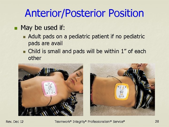 Anterior/Posterior Position n May be used if: n n Rev. Dec 12 Adult pads