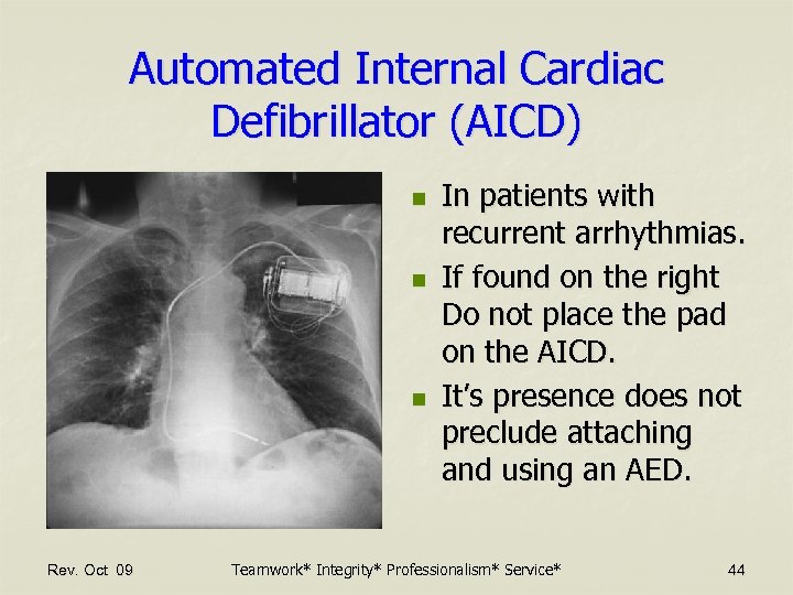 Automated Internal Cardiac Defibrillator (AICD) n n n Rev. Oct 09 In patients with