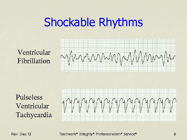 Shockable Rhythms Ventricular Fibrillation Pulseless Ventricular Tachycardia Rev. Dec 12 Teamwork* Integrity* Professionalism* Service*