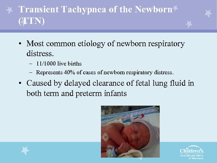 Transient Tachypnea of the Newborn (TTN) • Most common etiology of newborn respiratory distress.