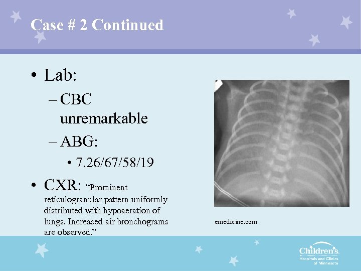 Case # 2 Continued • Lab: – CBC unremarkable – ABG: • 7. 26/67/58/19