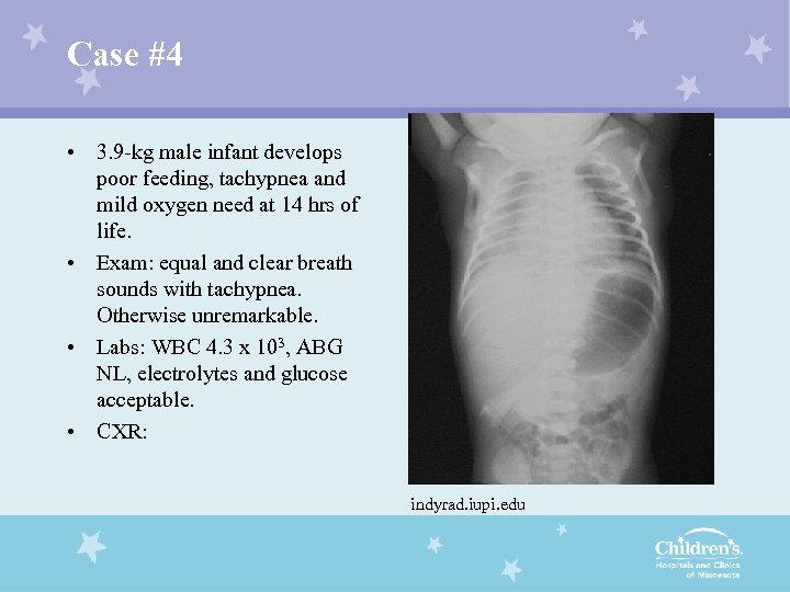 Case #4 • 3. 9 -kg male infant develops poor feeding, tachypnea and mild