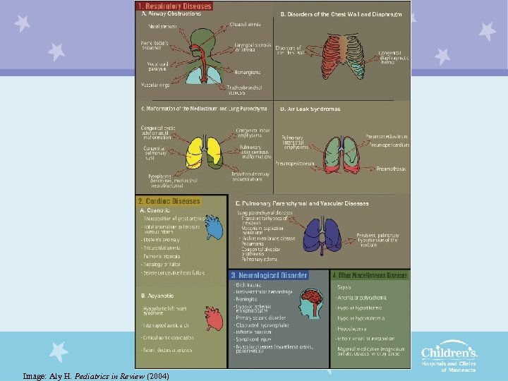 Image: Aly H. Pediatrics in Review (2004) 