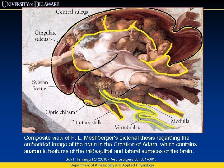 Michelangelo The Sistine Chapel And The Brainstem Suk