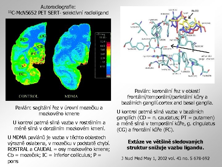Autoradiografie: 11 C-Mc. N 5652 PET SERT- selektivní radioligand Pavián: sagitální řez v úrovni