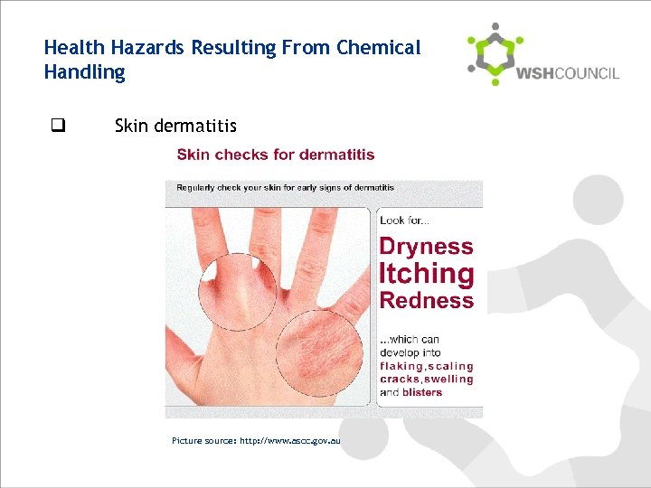 Health Hazards Resulting From Chemical Handling q Skin dermatitis Picture source: http: //www. ascc.