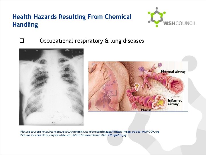 Health Hazards Resulting From Chemical Handling q Occupational respiratory & lung diseases Picture source: