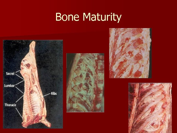Bone Maturity 