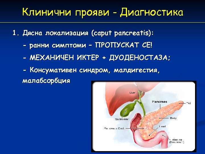 Клинични прояви - Диагностика 1. Дясна локализация (caput pancreatis): - ранни симптоми – ПРОПУСКАТ