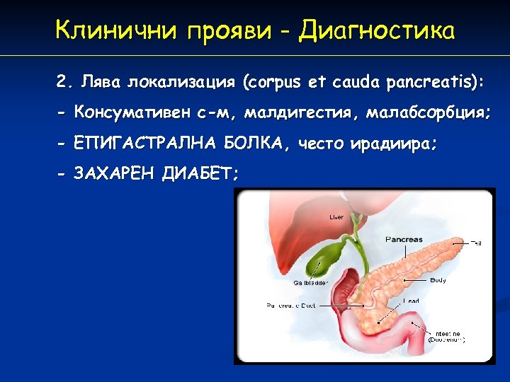 Клинични прояви - Диагностика 2. Лява локализация (corpus et cauda pancreatis): - Консумативен с-м,