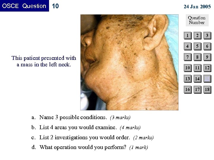 OSCE Question 10 24 Jan 2005 Question Number 1 c. List 2 investigations you