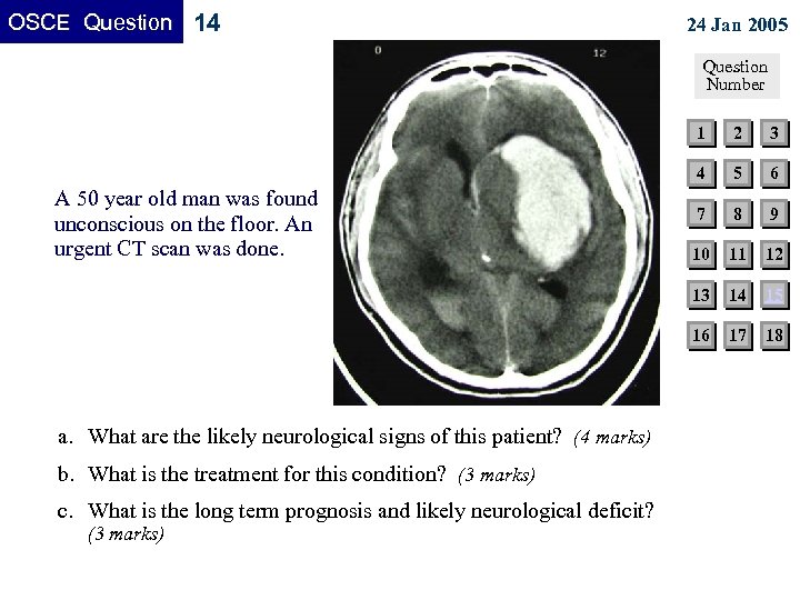 OSCE Question 14 24 Jan 2005 Question Number 1 c. What is the long
