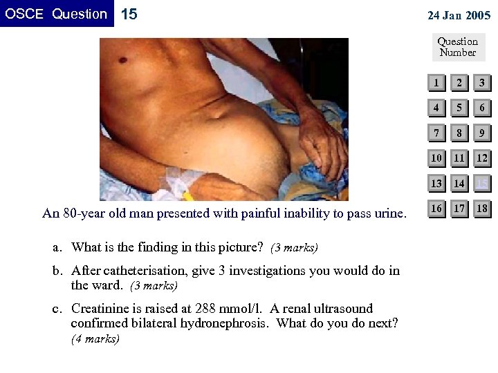 OSCE Question 15 24 Jan 2005 Question Number 1 (4 marks) 8 9 11