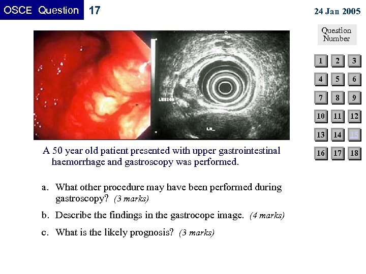 OSCE Question 17 24 Jan 2005 Question Number 1 8 9 11 12 13