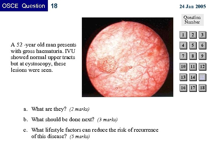 OSCE Question 18 24 Jan 2005 Question Number 1 b. What should be done