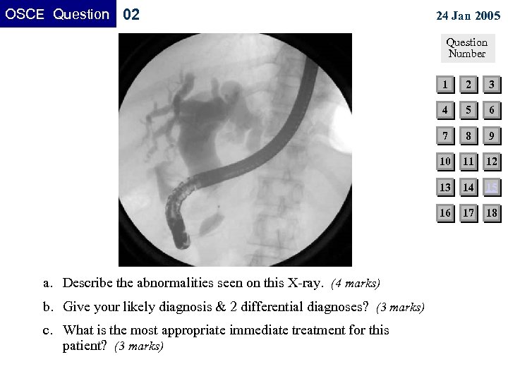 OSCE Question 02 24 Jan 2005 Question Number 1 6 8 9 10 11