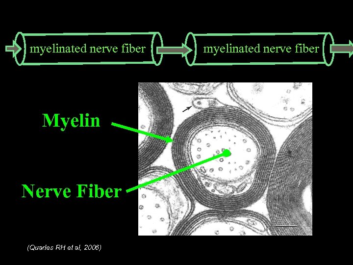 myelinated nerve fiber $721 million cumulative research investment (estimated through 2010) Myelin Nerve Fiber