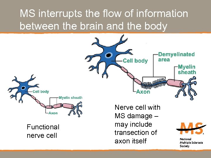 MS interrupts the flow of information between the brain and the body $721 million