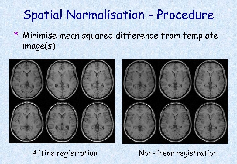 Spatial Normalisation - Procedure * Minimise mean squared difference from template image(s) Affine registration