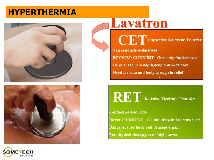 HYPERTHERMIA Lavatron CET Capacitive Electrode Transfer Non conductive electrode INDUCED CURRUNT –Guaranty the Safeness