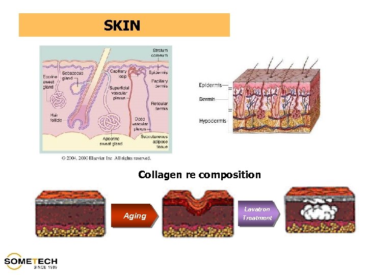 SKIN Collagen re composition Aging Lavatron Treatment 