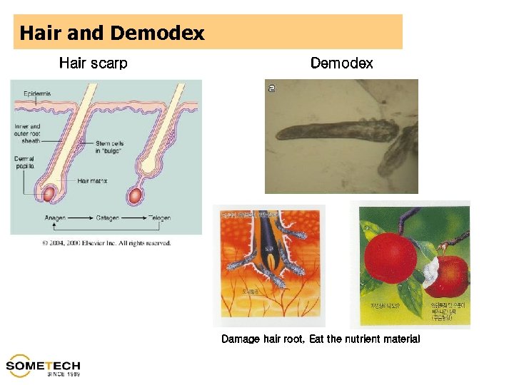 Hair and Demodex Hair scarp Demodex Damage hair root, Eat the nutrient material 