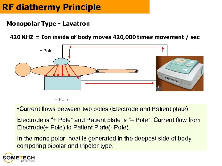 RF diathermy Principle Monopolar Type - Lavatron 420 KHZ = Ion inside of body