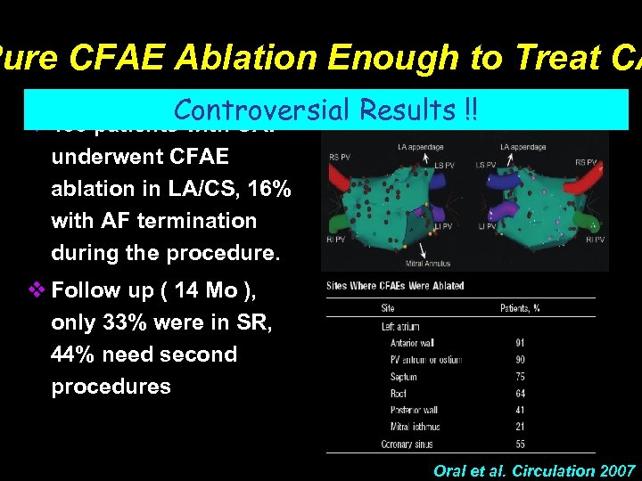 Pure CFAE Ablation Enough to Treat CA Controversial Results !! v 100 patients with