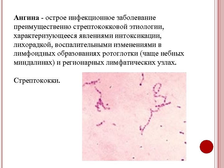 Ангина - острое инфекционное заболевание преимущественно стрептококковой этиологии, характеризующееся явлениями интоксикации, лихорадкой, воспалительными изменениями