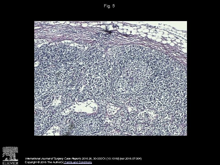 Fig. 5 International Journal of Surgery Case Reports 2016 26, 30 -33 DOI: (10.